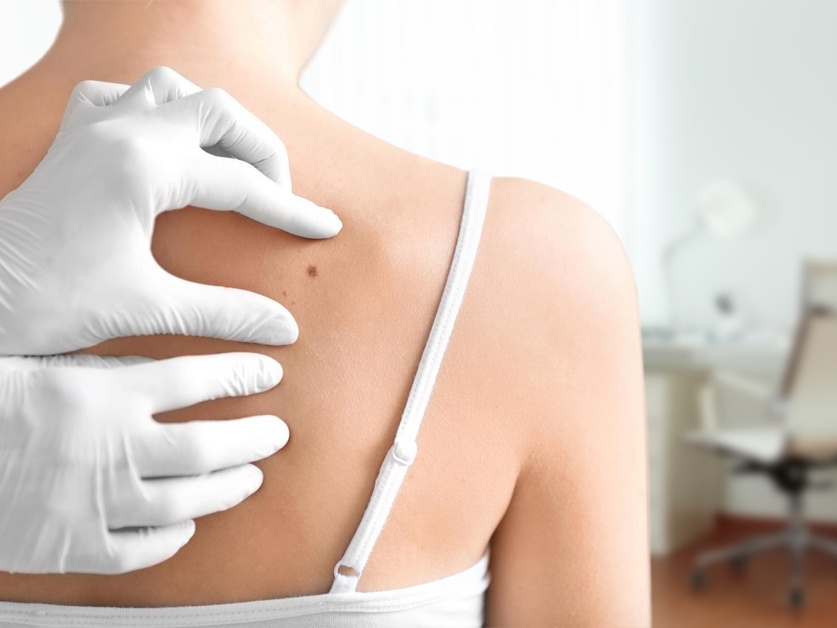 Kožní ordinace - Dermacentrum Neratovice - MUDr. Radek Pavlíček