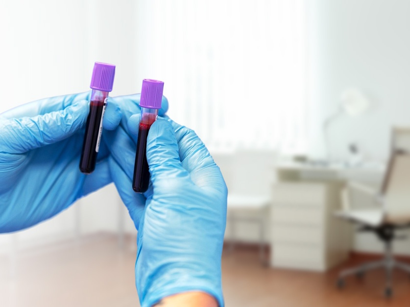 Odběrová laboratoř - VIDIA-DIAGNOSTIKA, s.r.o.